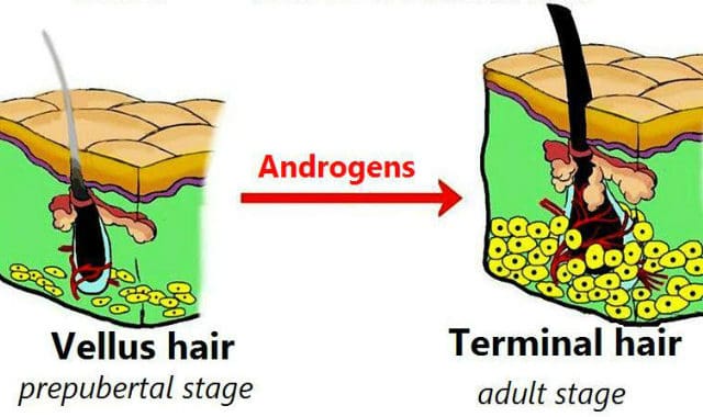 androgen effects on hair follicle