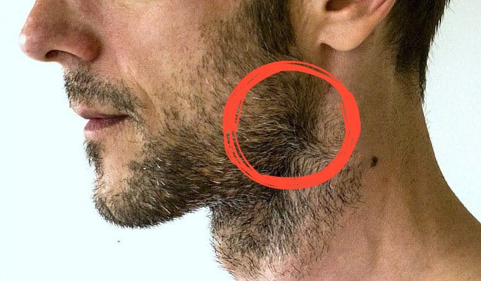 beard cowlick example on a stubble