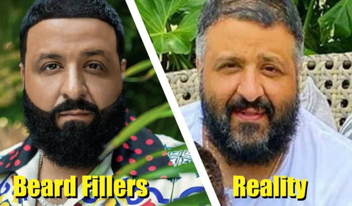 beard fillers before after