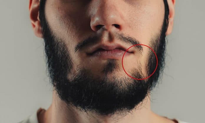 beard wont connect featured image