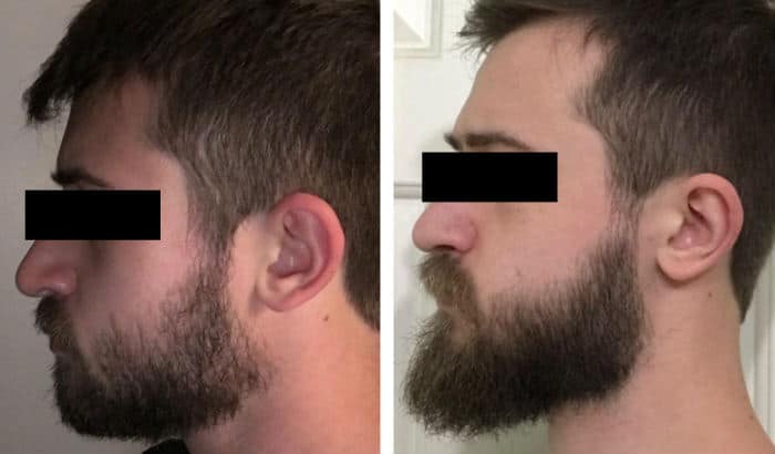 grow longer chin beard to improve jawline