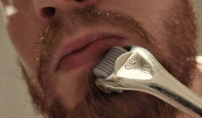 man dermarolling his beard area