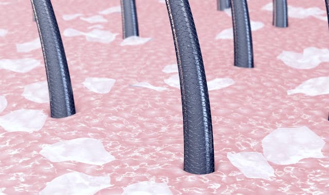 illustration of dry flaky skin cells in facial hair