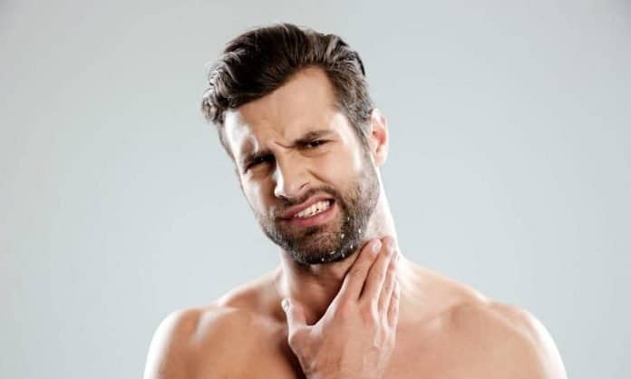 man with beard dandruff on his face