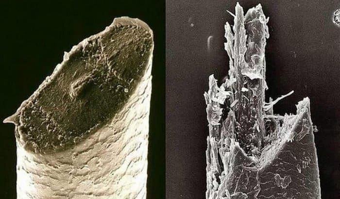 razor vs electric shaver beard hair microscopic