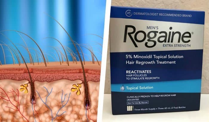 illustration of beard hair follicles with rogaine box