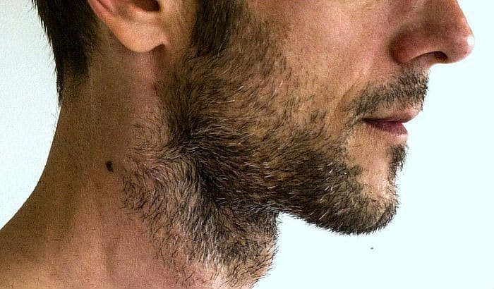 untrimmed heavy stubble