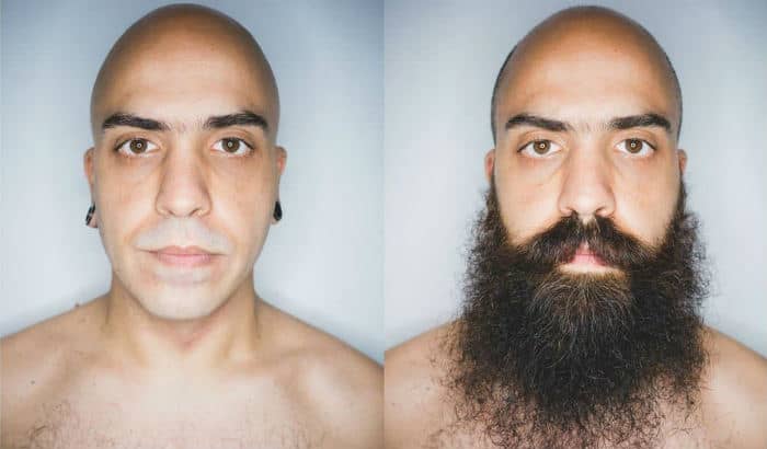 yeard before after